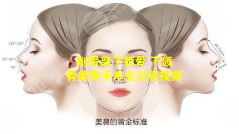削骨磨下颌骨 下颌骨磨骨手术全过程视频